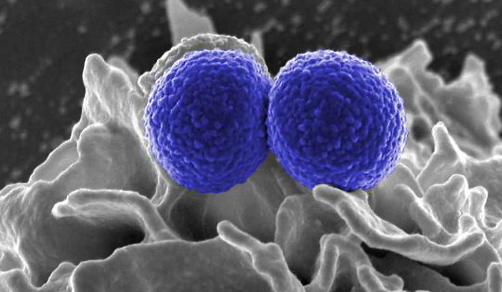 image of mrsa; Image Credit: National Institute of Allergy and Infectious Diseases (NIAID)