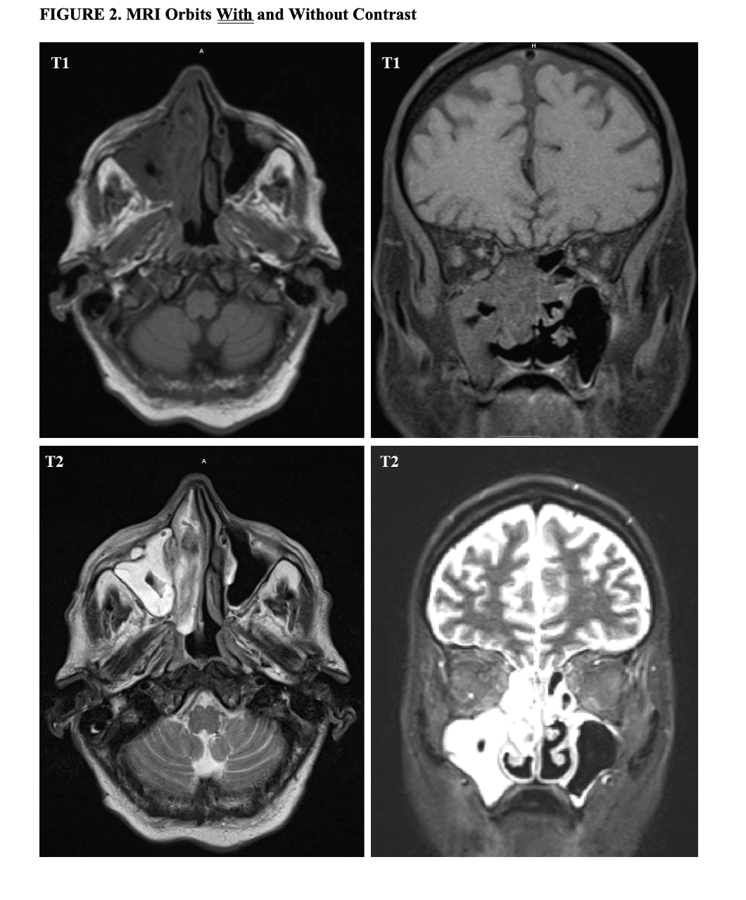 Image credit: Ian Adrian F. Frani, MD, BSN