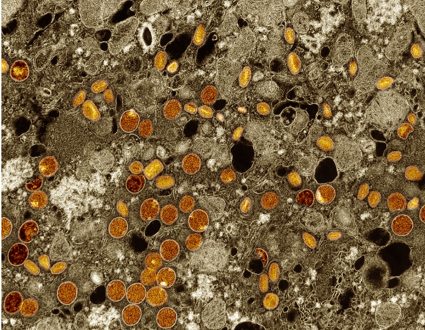 Colorized transmission electron micrograph of mpox virus particles (red/yellow) found within infected VERO E6 cells (brown). The virus particles are in various stages of maturity, which accounts for differences in shape. Captured at the NIAID Integrated Research Facility in Fort Detrick, Maryland. NIAID