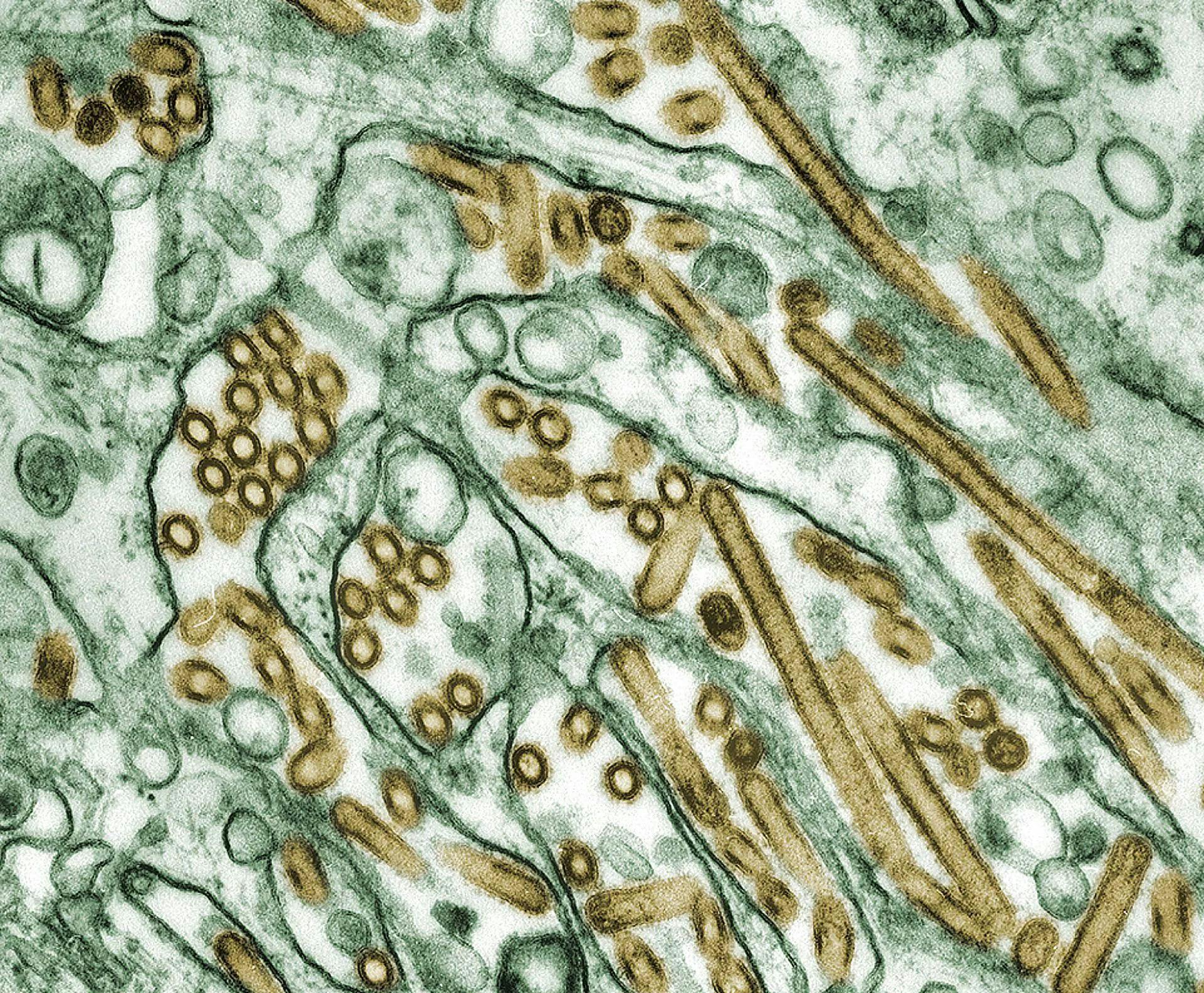avian flu; microscopic avian flu; image credit CDC