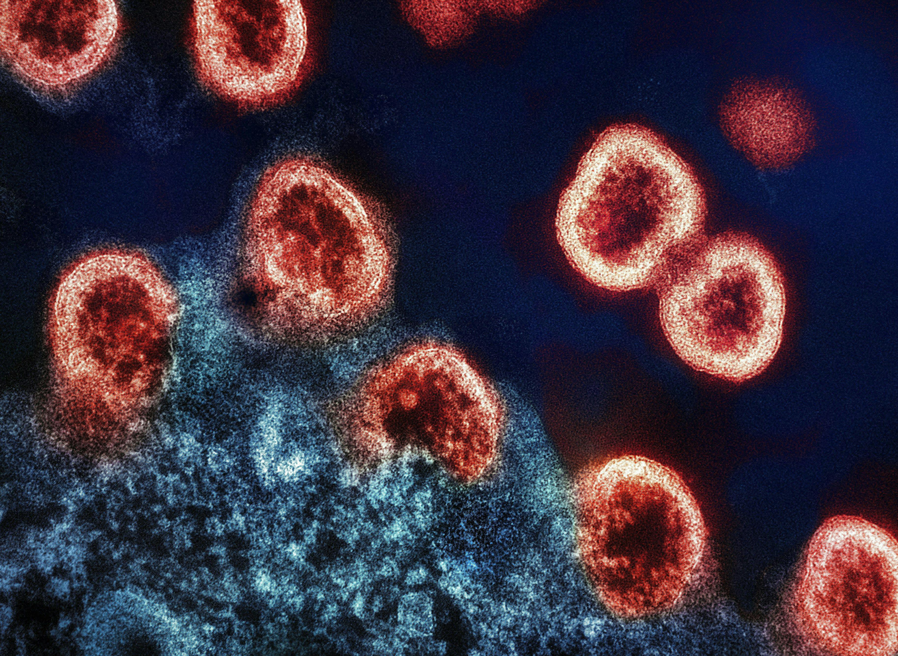 The Evolution of Lenacapavir in HIV Treatment